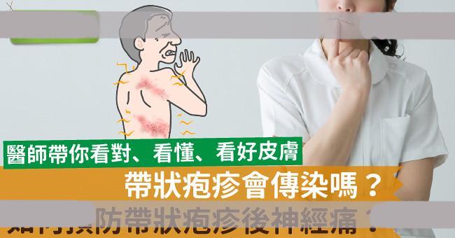 带状疱疹会传染吗？如何预防带状疱疹后神经痛？